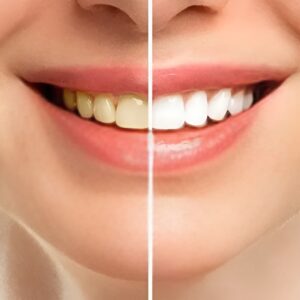 Natural Tooth Strengthening & Whitening Powder